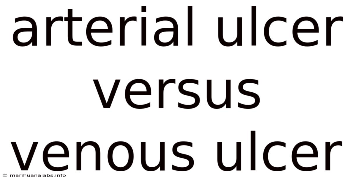 Arterial Ulcer Versus Venous Ulcer