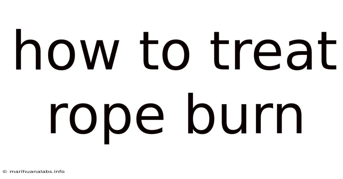 How To Treat Rope Burn