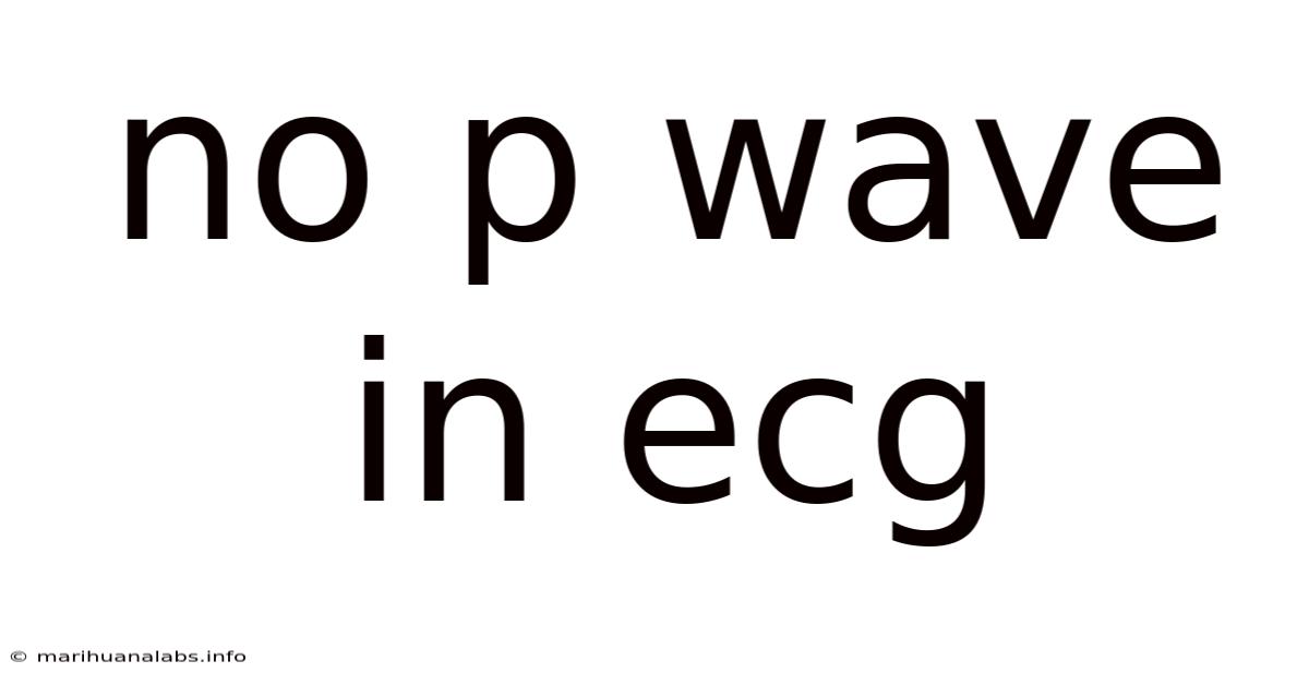 No P Wave In Ecg