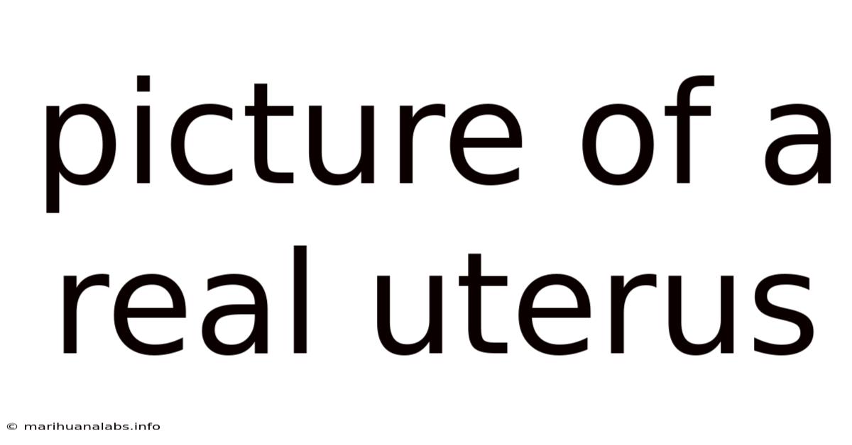 Picture Of A Real Uterus